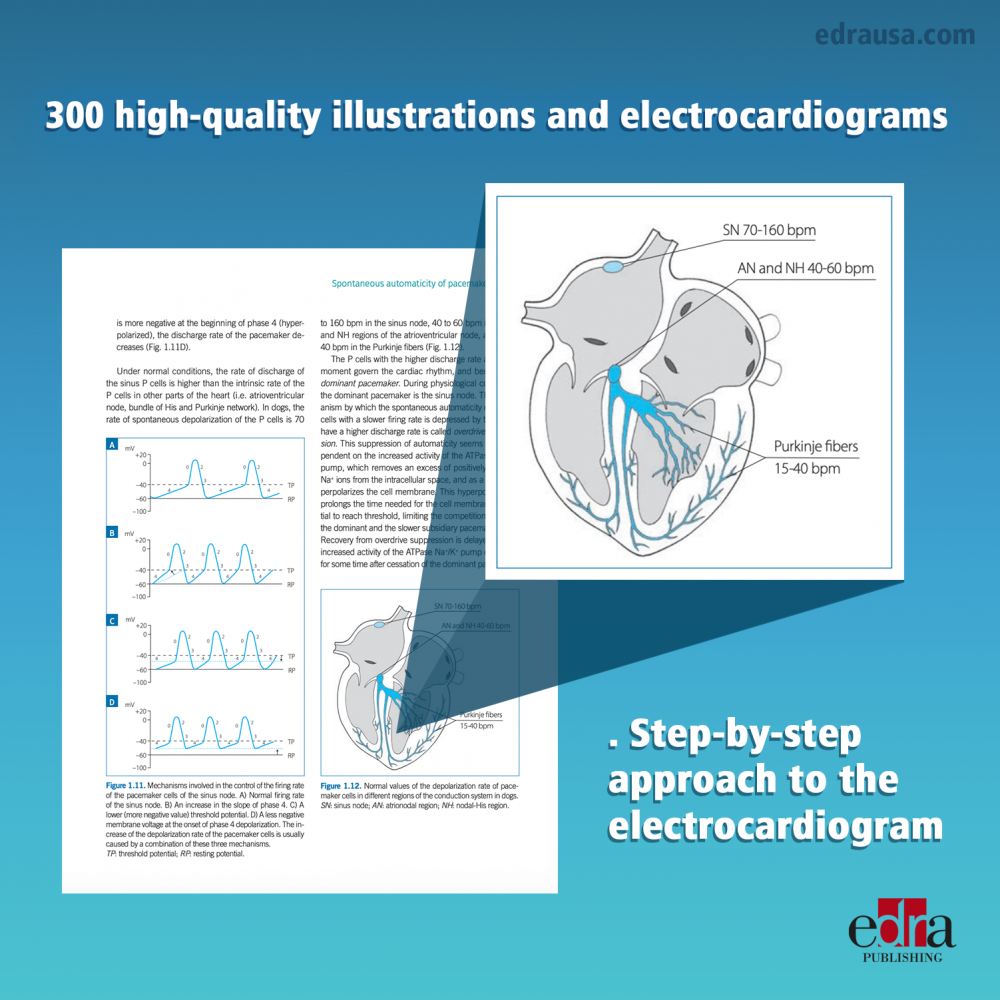 Electrocardiography of the dog and cat. Diagnosis of arrhythmias. II Edition